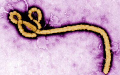 Risico op ebola voor Curaçao is momenteel erg laag